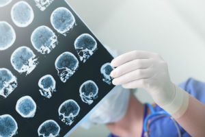 traumatic brain injury awareness month